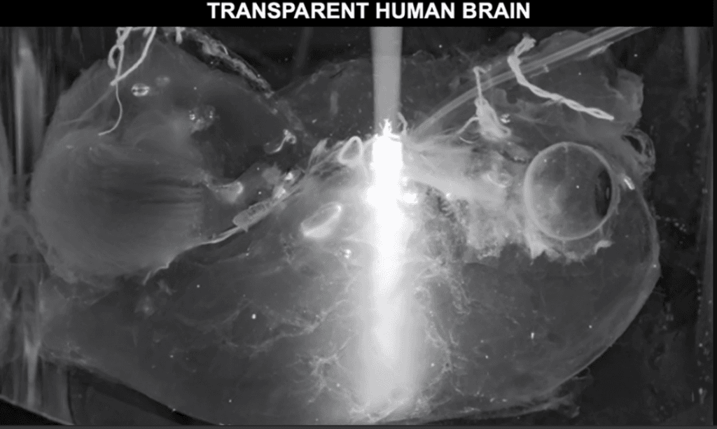 feat-33974-Screen-Shot-2020-02-27-at-14.00.18-1024×613-1